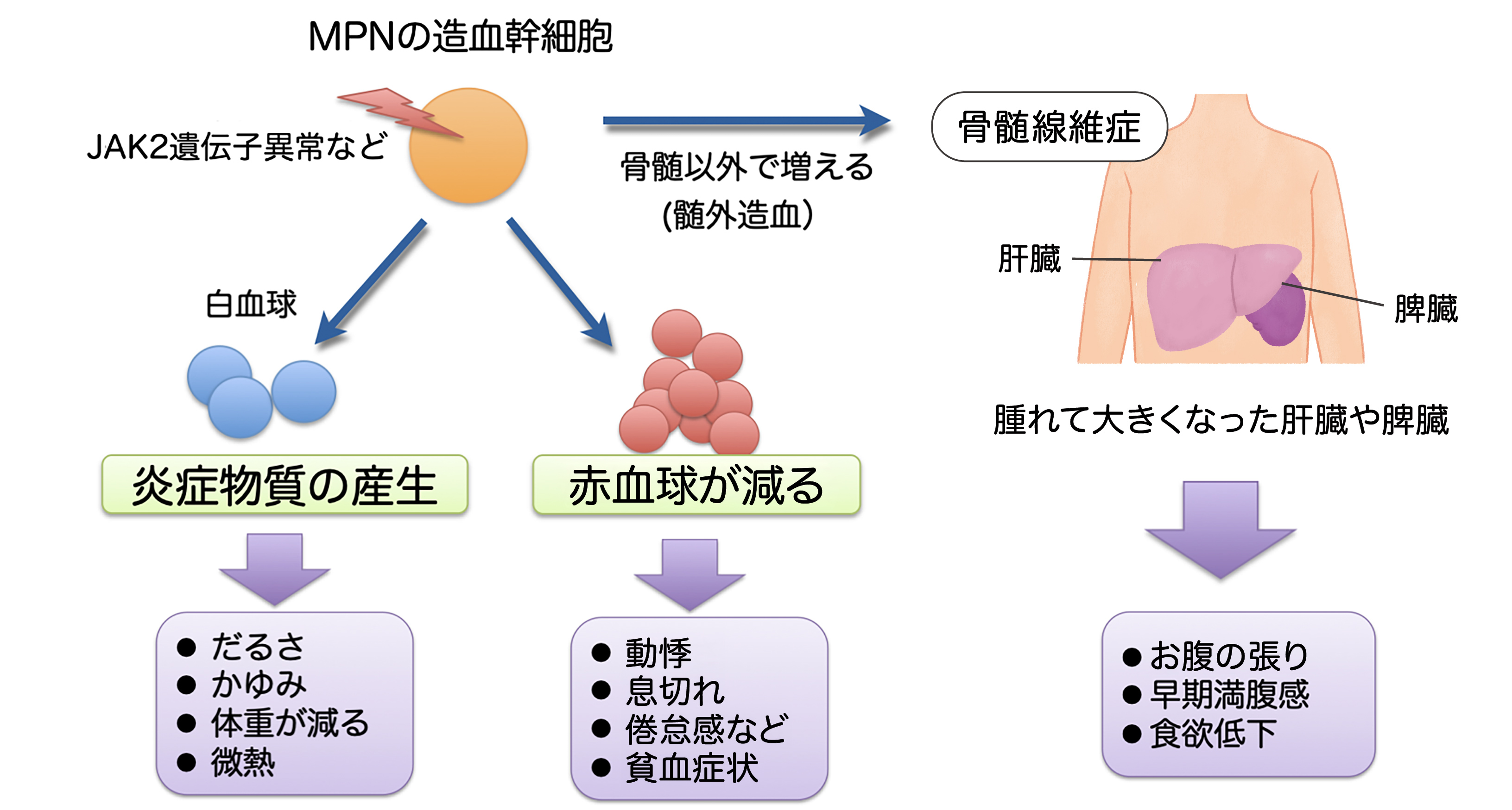 骨髄線維症の症状